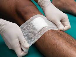 Không tự ý điều trị vết thương hở bằng phương pháp dân gian